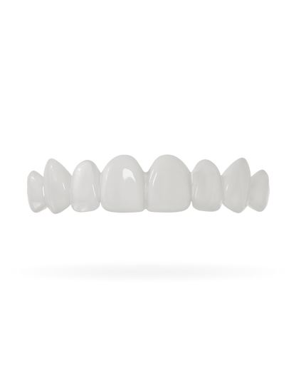 Teeth-Veneer 3.0