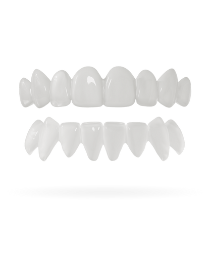 Teeth-Veneer 3.0